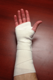 apply ace wrap(hand)